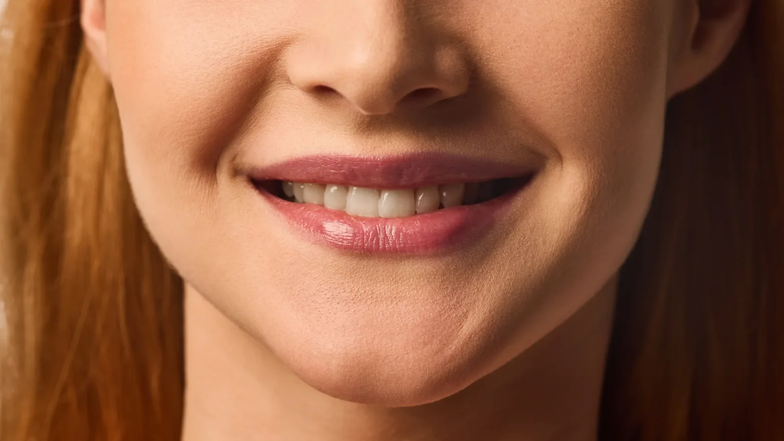 Lip Lift — ενδεικτική εικόνα